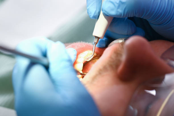 Best After-Hours Emergency Dentist in Shannon, GA